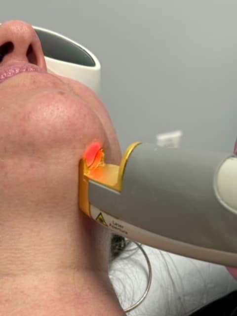 Laser Hair Removal Evergreen CO
